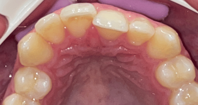 Before - Rothwell Dental