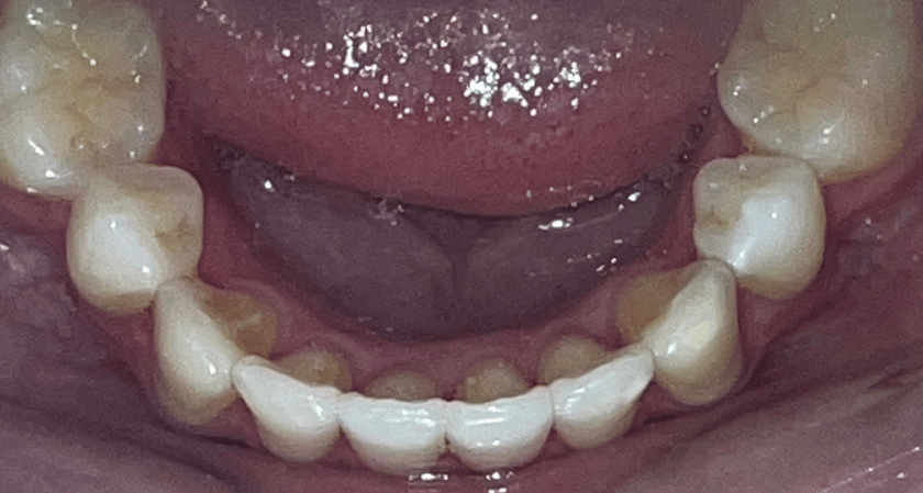 After -Rothwell Dental