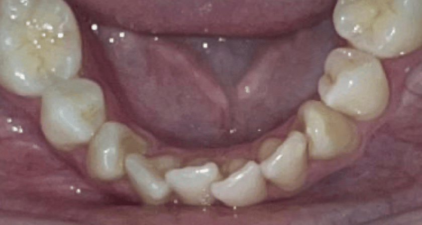 Before - Rothwell Dental